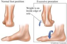 ankle-position-226-150